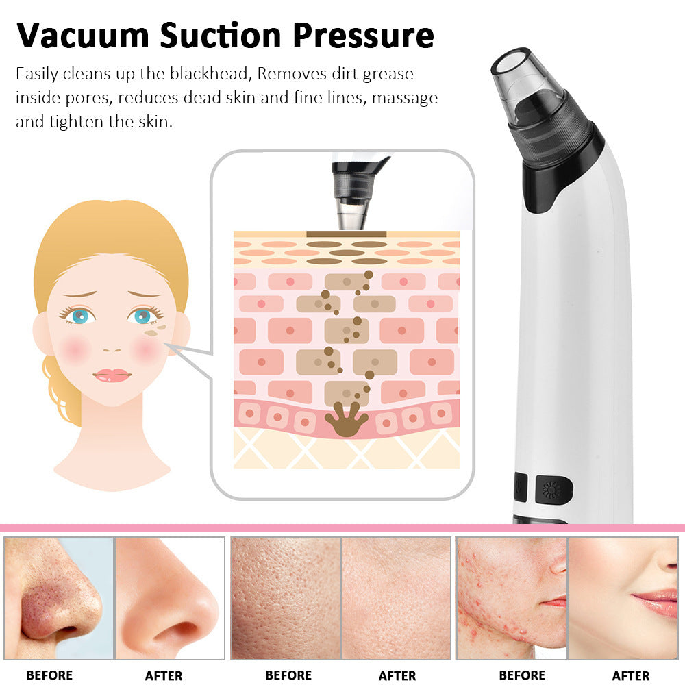 Electric Pore Vacuum